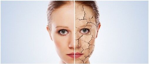 Nous traitons le psoriasis